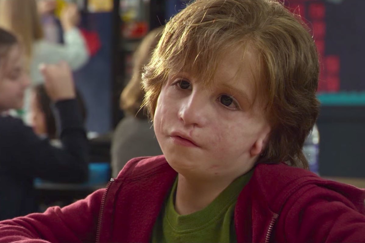 Wonder (2017)